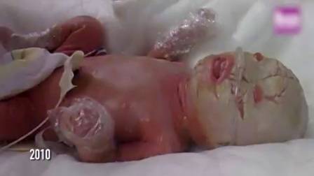 【囧闻怪谈】男孩疑似外星人浑身鳞片